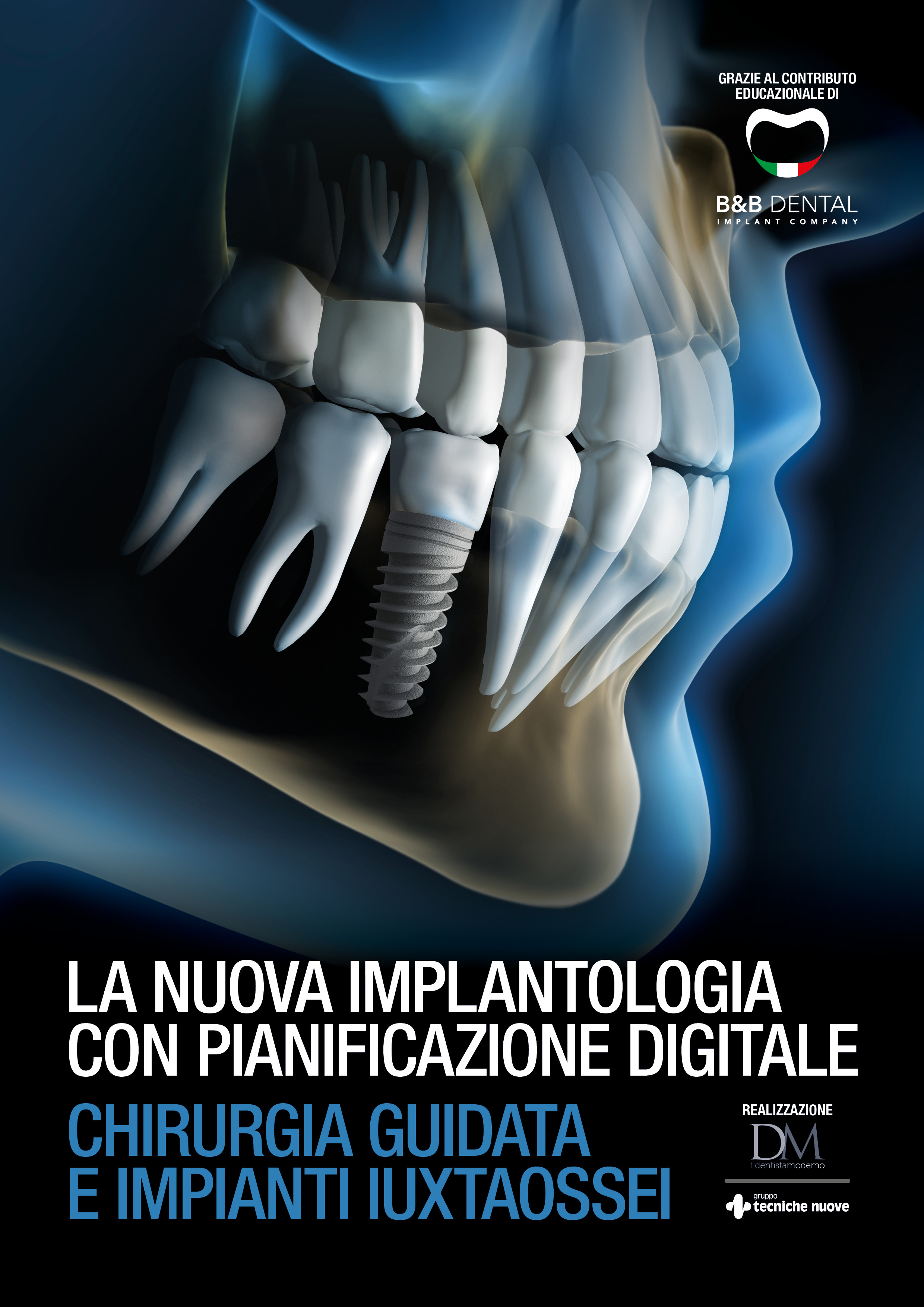 DM B&B Dental - La nuova implantologia con pianificazione digitale cover